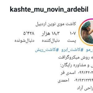 کاشت موی نوین