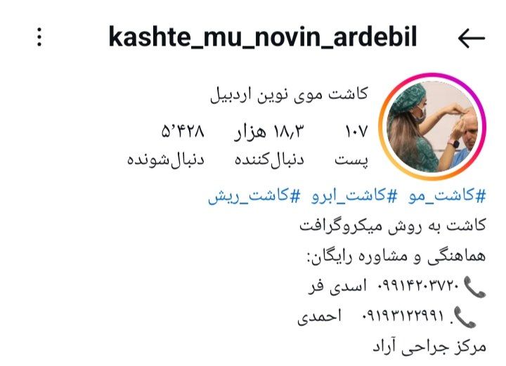 کاشت موی نوین